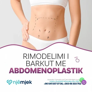 Abdomenoplastik
