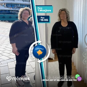 Para & Pas Obezitet