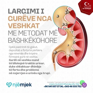 Trajtimet me Një Mjek