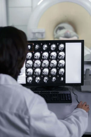 Pet CT