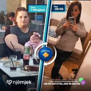Para & Pas Obezitet