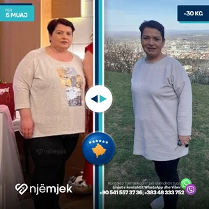 Para & Pas Obezitet