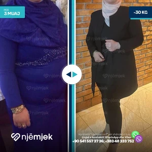 Para & Pas Obezitet