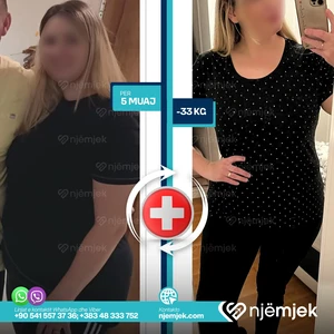 Para & Pas Obezitet