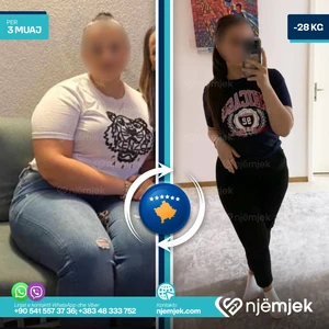 Para & Pas Obezitet