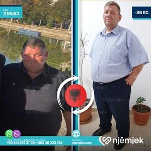Para & Pas Obezitet