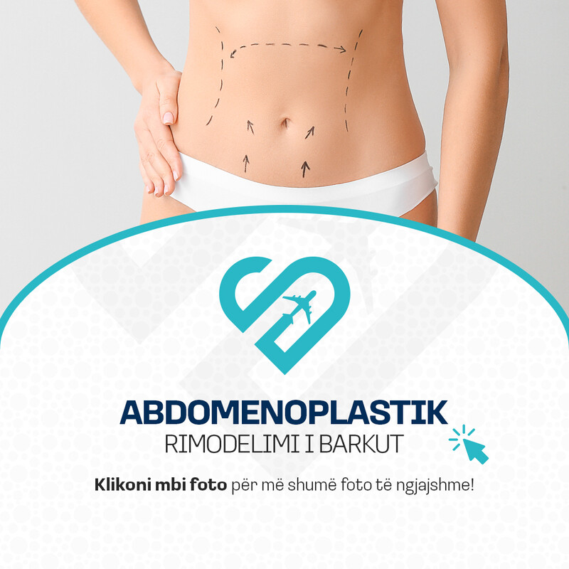 Abdomenoplastik