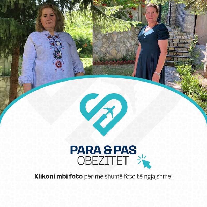 Para & Pas Obezitet