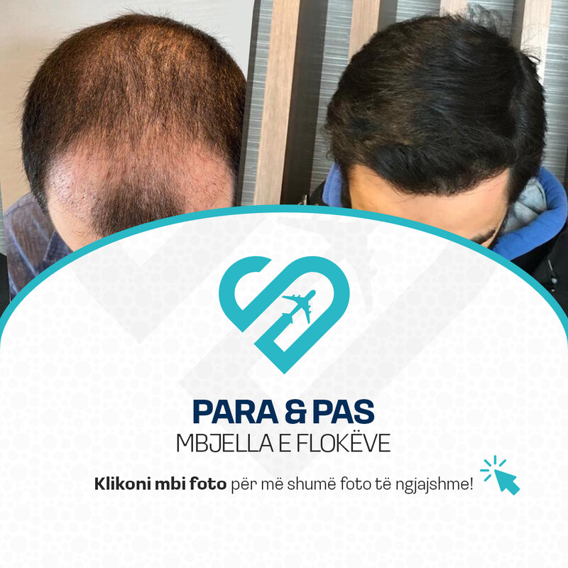Para & Pas Mebjella e Flokëve