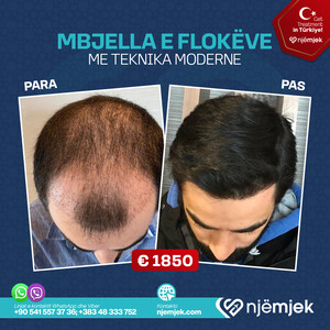 Para & Pas Mebjella e Flokëve