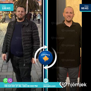 Para & Pas Obezitet