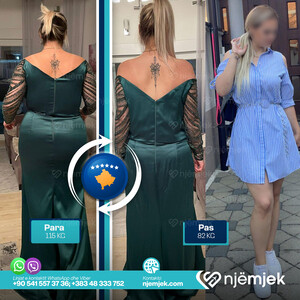 Para & Pas Obezitet