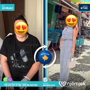 Para & Pas Obezitet
