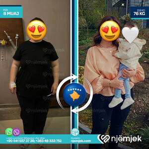 Para & Pas Obezitet