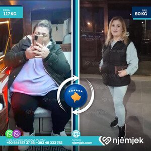 Para & Pas Obezitet