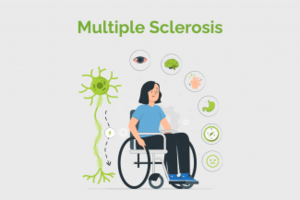 Skleroza e Shumëfishtë (MS): Shkaqet, Simptomat dhe Trajtimi