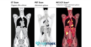 PET Scan - Tomografia e Emetimit të Pozitroneve