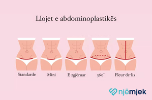 Rimodelimi i Barkut (Abdominoplastika)