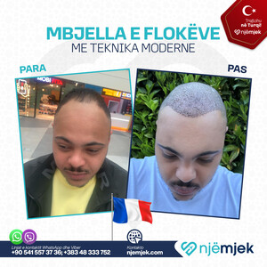 Para & Pas Mebjella e Flokëve