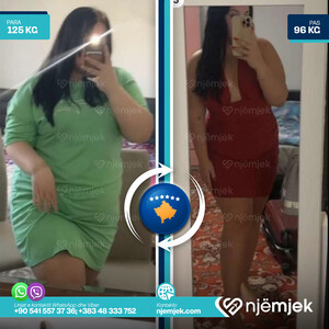 Para & Pas Obezitet
