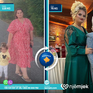 Para & Pas Obezitet