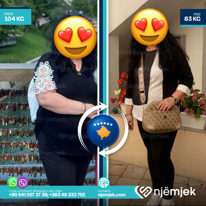 Para & Pas Obezitet