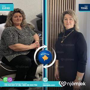 Para & Pas Obezitet