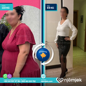 Para & Pas Obezitet