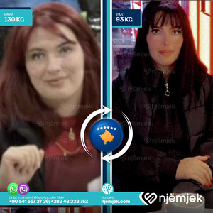 Para & Pas Obezitet