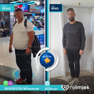 Para & Pas Obezitet