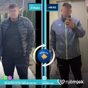 Para & Pas Obezitet