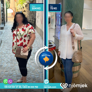 Para & Pas Obezitet