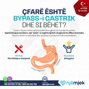 Trajtimet me Një Mjek
