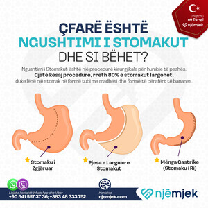 Trajtimet me Një Mjek