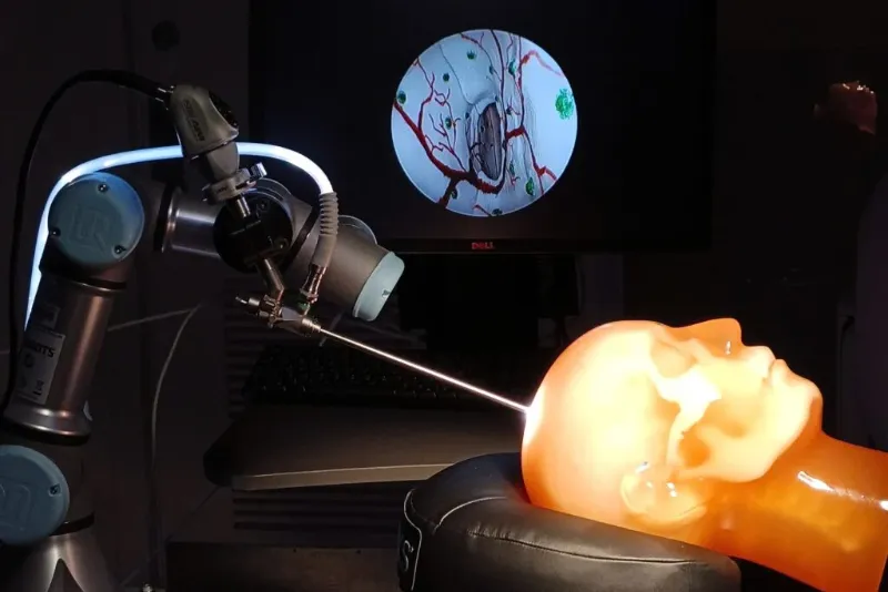 Roli i Teknologjisë Moderne në Operacionet Cerebrale