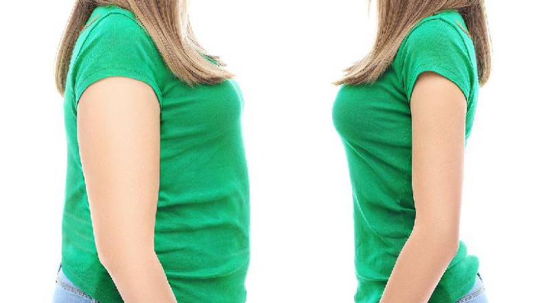 A mund të rifitoni peshë pas operacionit gastric sleeve?