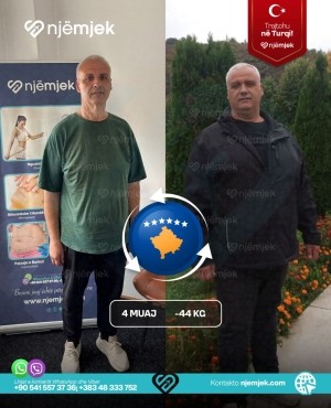 Para & Pas Obezitet