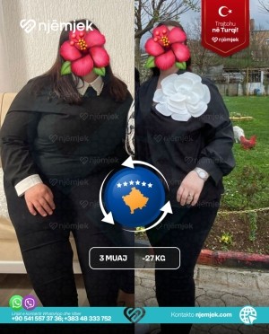 Para & Pas Obezitet