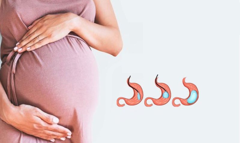 A mund të mbetem shtatzënë pas operacionit gastric sleeve?