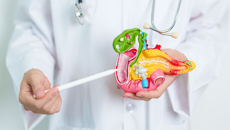 Tumori në papilla Vateri: Çfarë është, si diagnostikohet dhe cilat janë opsionet e trajtimit në Turqi